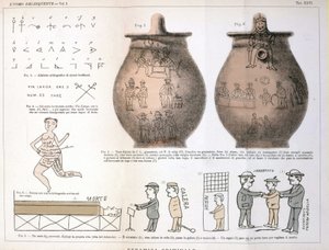 イタリアの犯罪学者チェーザレ・ロンブローゾ（1835-1909）が研究した「犯罪者」（L