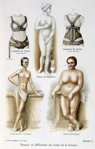 女性の体の美しさと奇形（痩せ型と肥満）；ジュノのベルト-"The woman, home doctor "にて 作： Unknown artist