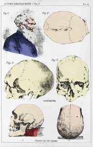 イタリアの犯罪学者による非行少年の頭蓋骨の形態に関する研究 作： Unknown artist