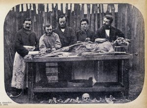 解剖、v.1865。
