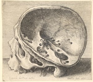 頭蓋骨の左側が取り除かれた、左側が横から見た断面の頭蓋骨、1651年。 作： Wenceslaus Hollar