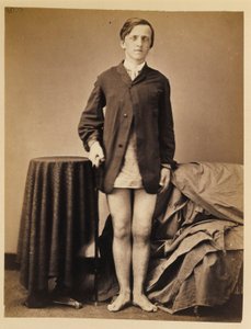 G．W・ウォリントン、右膝蓋骨の銃創後、切断することなく回復（外科部門の写真カタログより 作： William Bell