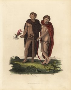 アルビノのアフリカ人男性と女性。