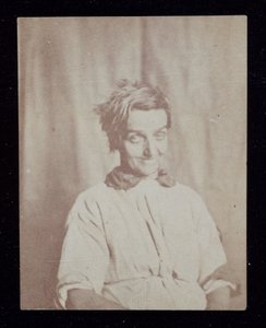 精神医学 患者の肖像、サリー・カウンティ・アサイラム、1852年頃 作： John Pardon