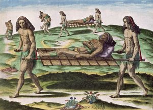 「ブレビスナラティオ...」からの負傷者を運ぶ雌雄同体、セオドアドブライ発行、1591年