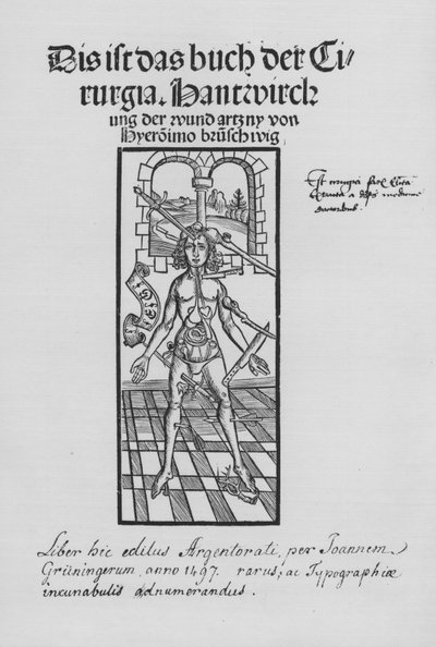 ヒエロニムス・ブルンシュウィグの「Cirurgiaの書」（リトグラフ版 作： (after) German School