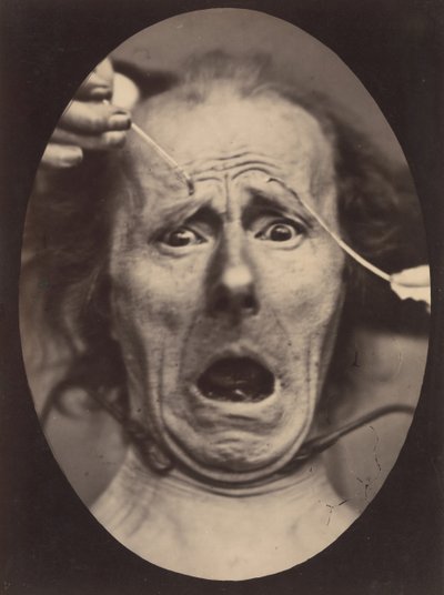 Electro-Physiology、Figure 64、1854-56、1862 年に印刷。 作： Adrien Alban Tournachon