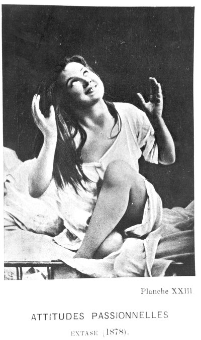 情熱的な態度：エクスタシーのアウグスティヌス、「欲望の丘」（1840〜1909）、ポール・レナード（1850〜1927）、1878年の「Iconographie de la Salpetriere」より 作： Albert Londe