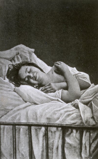 1878年にヒステリーの発作を起こした若い女性 作： Albert Londe