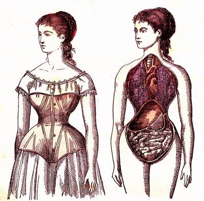 コルセットによる圧迫-J.レンガデによる通常の生活と健康。A・デマール 1881年 作： Alphonse Demarle