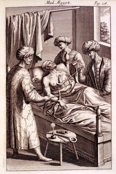 1745年のプロスペロアルピニによる医学エジプト人の灸のイラスト 作： American School