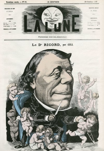 フランス人医師リコルドの肖像。ギルの漫画、「La Lune」10月20日号掲載 作： Andre Gill