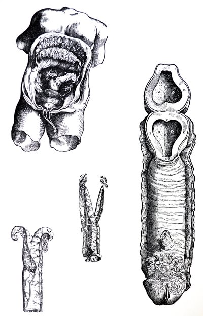 De Humani Corporis Fabricaの5冊目の版 作： Andreas Vesalius