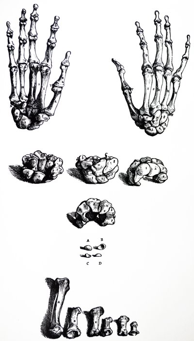 De Humani Corporis Fabricaの最初の本のプレート 作： Andreas Vesalius