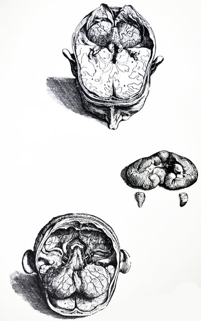 De Humani Corporis Fabricaの7番目の本のプレート 作： Andreas Vesalius