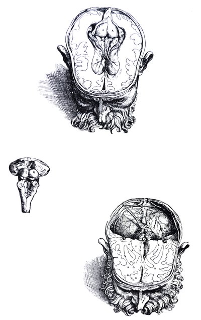 De Humani Corporis Fabricaの7番目の本のプレート 作： Andreas Vesalius