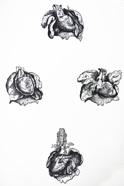 デヒューマニコルポリスファブリカの6冊目の版 作： Andreas Vesalius