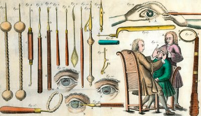 18世紀の外科手術：目の手術。白内障手術と人工瞳孔形成のための器具。ロレンツォ・ハイスターの「Institutionis chirurgicae」に掲載された版画 作： Anonymous Anonymous
