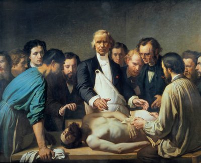 アルフレッド・ヴェロー医師（1795-1867）がチャリティーで解剖を進める 死体に介入する準備をしている学生たちに囲まれた医師。フランソワ・フェイアン・ペラン（1826-1888）の絵画。19世紀。トゥール美術館 - アルフレッド・ヴェルポー 作： Auguste (after) Feyen Perrin