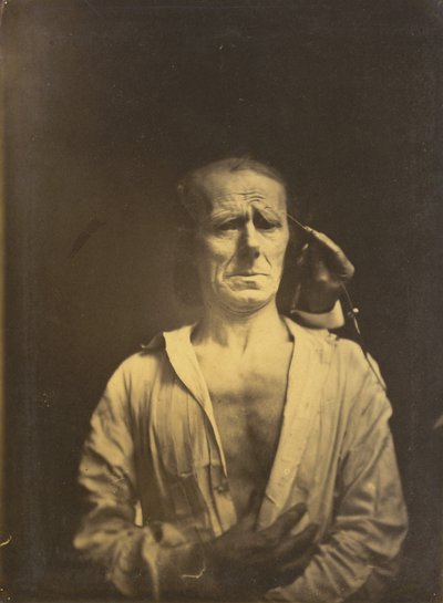 mの痙攣。 左の非常に強い光の下でのコルゲーター・スーパーシリイ、リラックスした顔...、1854-1855。 作： Duchenne de Boulogne