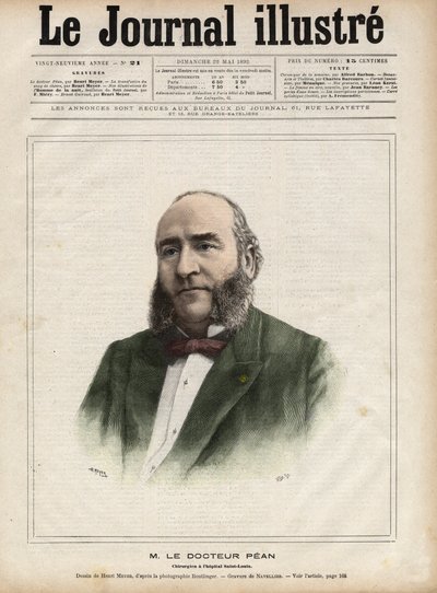 フランスの外科医、ジュール・エミール（Jules-Emile）・ペアン（1830-1898）の肖像 - 1892年の『幻想日記』に掲載されたナヴェリエによるエングレーヴィング 作： Edouard Felicien Eugene Navellier