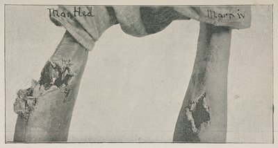 アレックスのエッセイ「The Peace Conference And The Dum-Dum Bullet」からの写真。 オグストン、ブリティッシュ・メディカル・ジャーナル、Vol。 2013年7月29日号 作： English Photographer