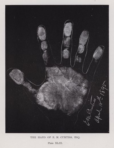 E・M・カーチスの手（モノクロ写真 作： English Photographer