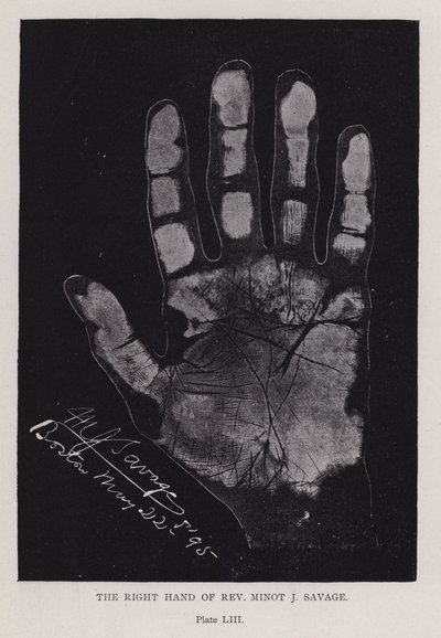 ミノット・J・サベージ師の右手（モノクロ写真 作： English Photographer