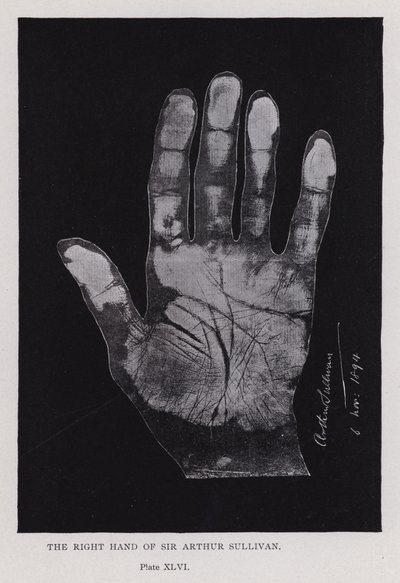 アーサー・サリバン卿の右手（モノクロ写真 作： English Photographer