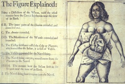 1177 b.19 「The Figure Explained」、子宮の図、「The Midwives Book or The Whole Art of Midwifery Discovered」、Jane Sharp、ロンドン 作： English School