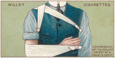 パッドと屈曲による補助動脈の圧迫、Wills Cigarettesカードの応急処置シリーズのno.41、1913 作： English School