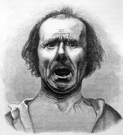 1872年に発行されたチャールズダーウィンの「人と動物の感情の表現」の図解、デュシェンヌ博士の写真からコピーされた恐怖と苦悩 作： English School