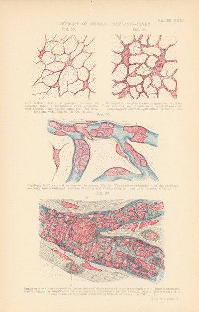 正常な生物形質の増加、発熱（カラーリトグラフ） 作： English School