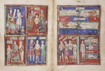 スローン 1975年 fol.91v-92 医療シーン 作： English School