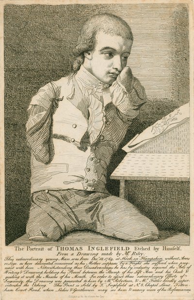 トーマスイングルフィールド、1769年12月18日、ハンプシャーのフックで生まれ、腕も脚もなし 作： English School