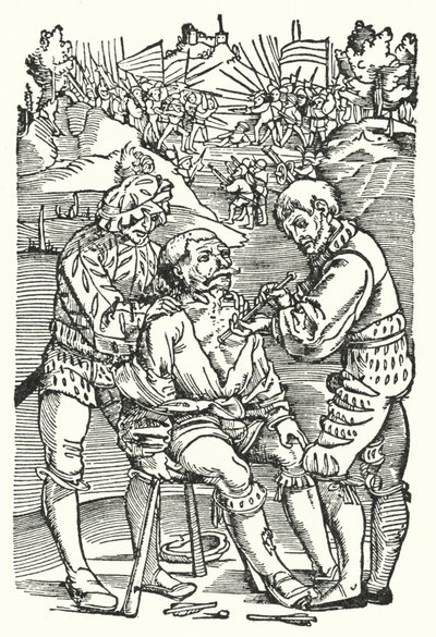 矢を取り除く理容師の外科医（彫刻） 作： European School