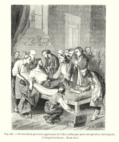 モートンはボストンの病院で外科手術のための硫酸エーテルの最初の適用をします 作： European School