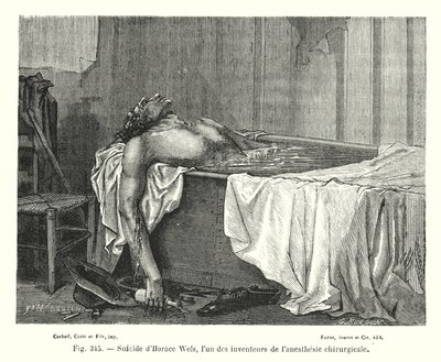 外科麻酔の発明者の一人であるホレス・ウエルスの自殺（エングレービング 作： European School