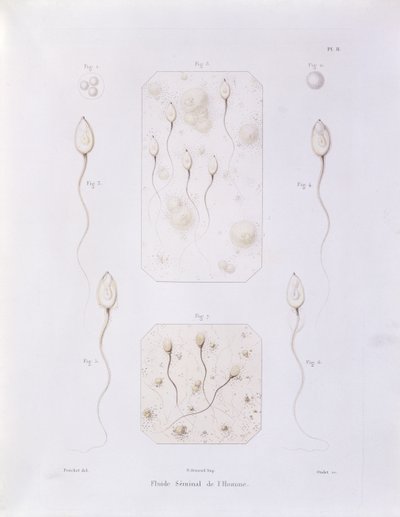 1847年、パリのオデットによって彫刻されたフェリックスアルキメドポーシェ（1800-72）による、哺乳類と人間の種の正の排卵と受精の理論による精液 作： Felix Archimede Pouchet