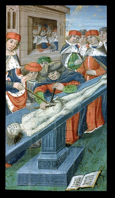 Ms Hunter 9 10r Dissection、De Medina Fen I. II、Avicenna（980-1037） 作： Flemish School