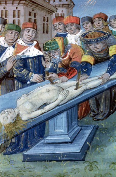 Ms Hunter 9 f.22r Dissection、De Medina Fen I. II、Avicenna（980-1037） 作： Flemish School