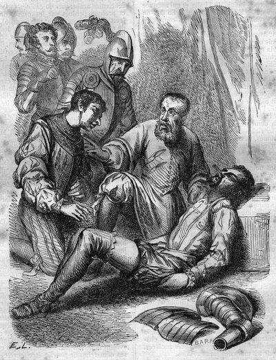 Ambroise Pare（フランスの外科医 作： French School