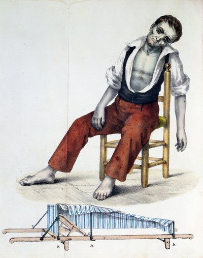 コレラモルバス、ヒストリカ、リラソン出身、Statistica e Medica da Cholera-Morbus by Francisco dAssis de Souza Vaz、1833 作： French School