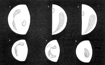 金星の暗斑と明斑。1,2,3は1667年にD.カッシーニが観測した斑点、4,5,6は1871年にM.ラングドンが観測した斑点-アメデ・ギユミンの「Le Ciel」にて 作： French School