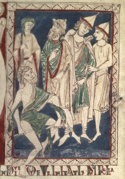 Fr.15307 f.1v彼の傷を掻く仕事 作： French School