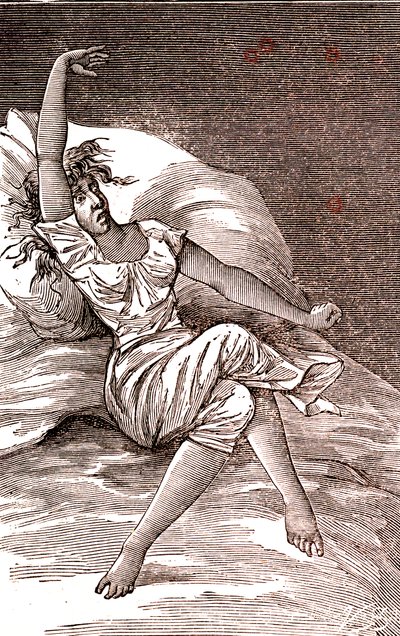頭痛、メランコリアとヒステリー、不安。1887年（エングレーヴィング） 作： French School