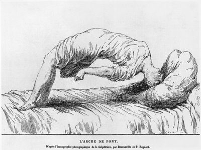 Les Maladies Epidemiques de lEspritのPaul Regnard（1850-1927）1884によるヒステリーと不眠症 作： French School
