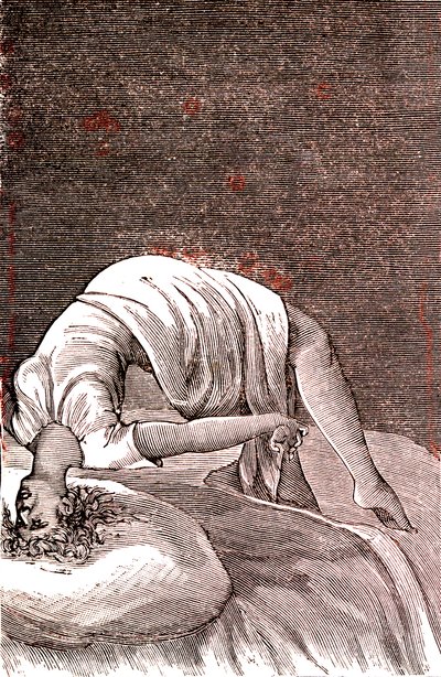 ヒステリー、強い不安から起こる精神・神経障害。1887年（エングレーヴィング） 作： French School