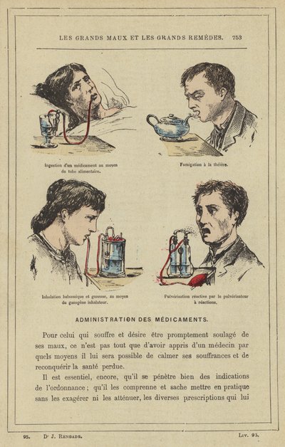 フードチューブによる薬剤の摂取、お茶による燻蒸、吸入ガス化装置によるバルサミコやガスの吸入、反応噴霧器による反応噴霧（カラーリトホ 作： French School