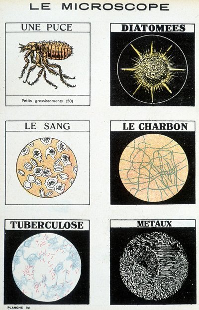 顕微鏡：チップ、珪藻類、血液、石炭、結核、金属。 作： French School